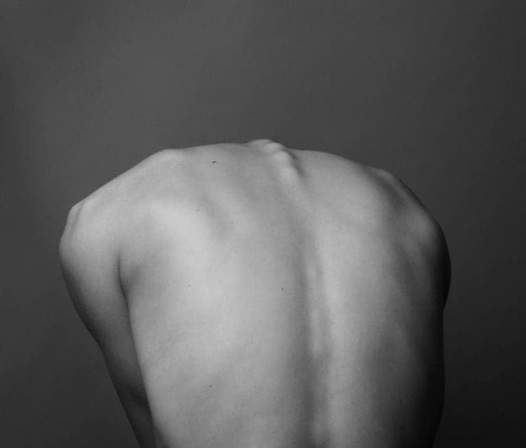 Effective Techniques To Stop The Progression Of Scoliosis